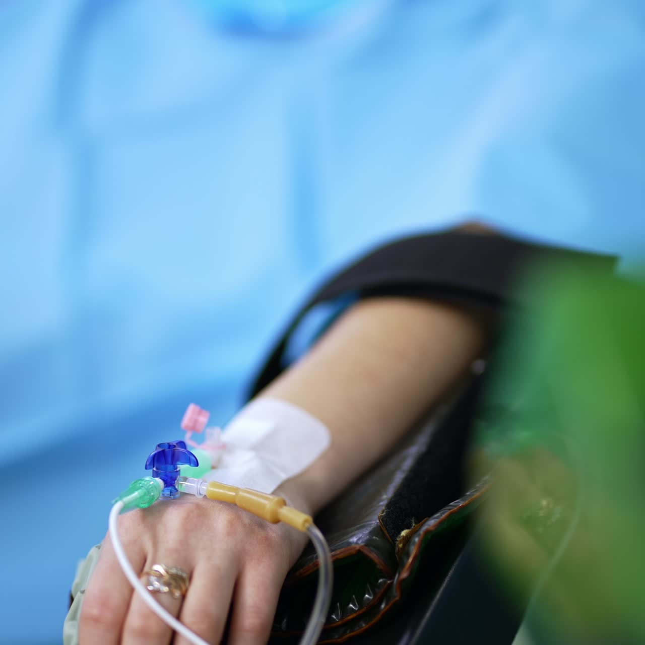 Mano femminile con tubi contagocce collegati. Paziente durante un'operazione. Primo piano. Sfondo sfocato