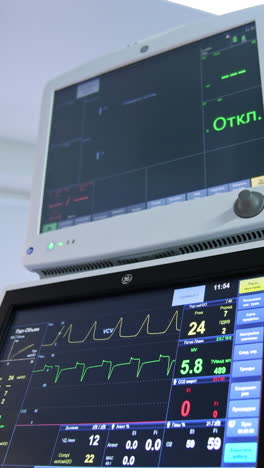 two screens of artificial lung ventilator. low angle view. equipment necessary for modern surgeries in operational theatre. vertical video