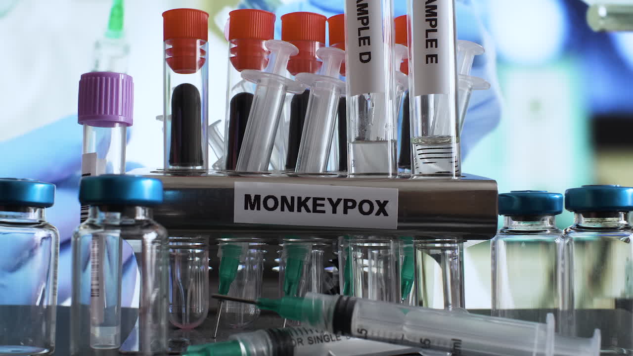 랙에 배치되는 monkeypox 테스트 튜브 샘플