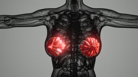 exploración médica del cáncer de mama de la mujer