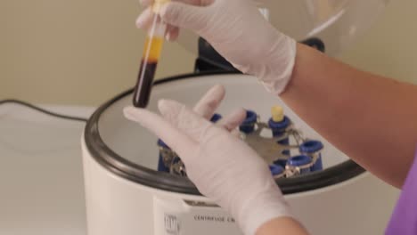 platelet-rich plasma preparation. tube with blood in hands. centrifuge. background