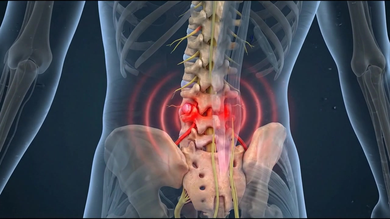 Human back spine model highlighting lumbar region pain area