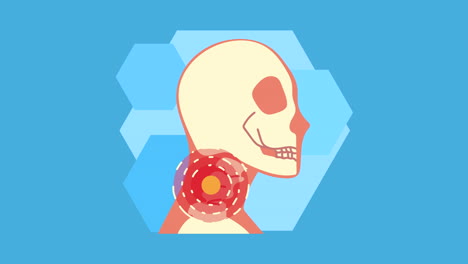 dolor de cuello reumatología animación de la enfermedad