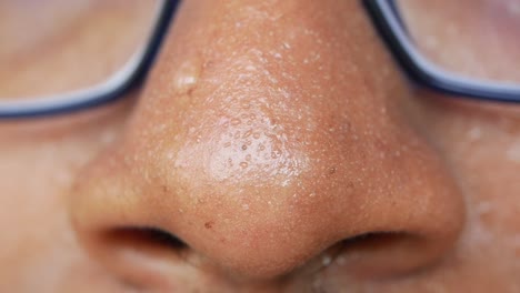 close-up of a person's sweaty nose