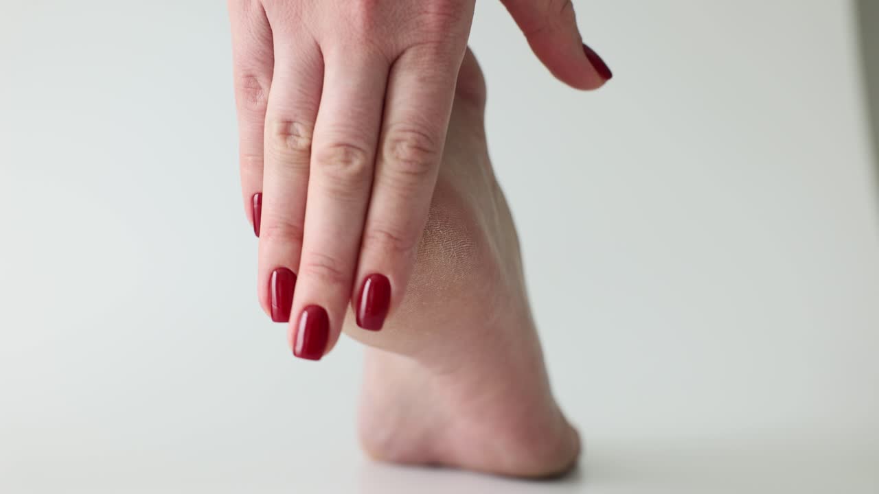 Dry and Cracked Heel with Red Nails