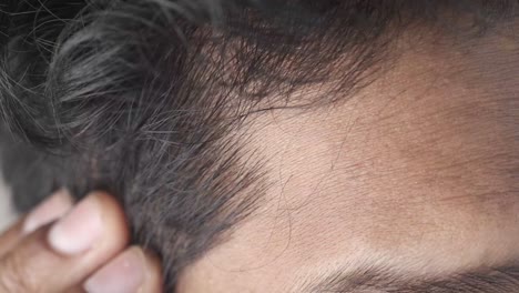 closeup of a person's forehead and hair