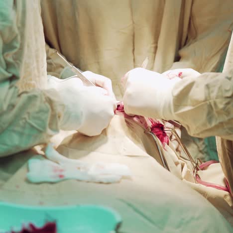 medical team performing operation. group of surgeon at work in operating theatre