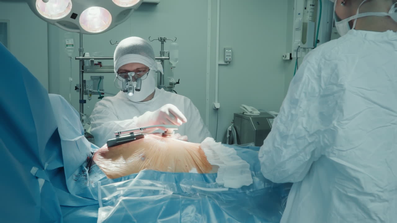 el médico expande el pecho del paciente con un retractor en la habitación. el cirujano de cardiología abre la herida para realizar una cirugía de derivación de la arteria coronaria en una clínica moderna