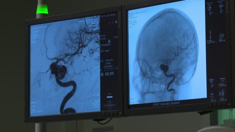 results of patient medical scan displayed on hospital monitor screen