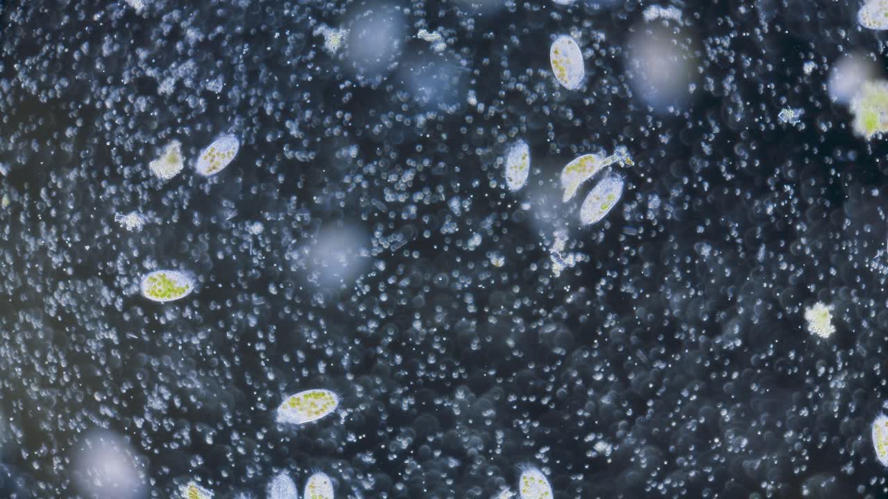 Yksisoluinen paramesium, jonka sisällä on symbioottinen levä