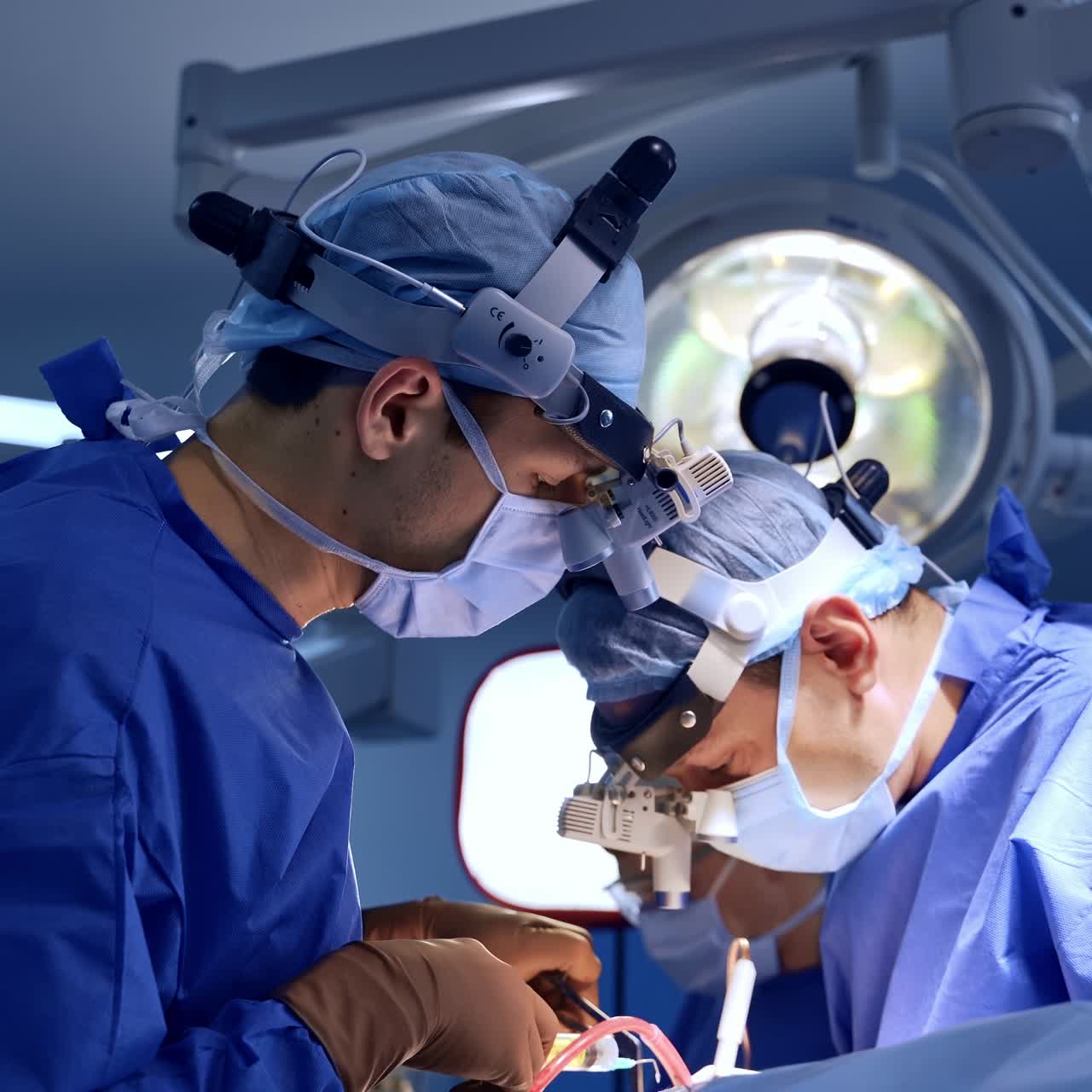 Neurocirujanos concentrados operando al paciente con herramientas. Los médicos llevan unas gafas de dispositivo mientras realizan la cirugía.