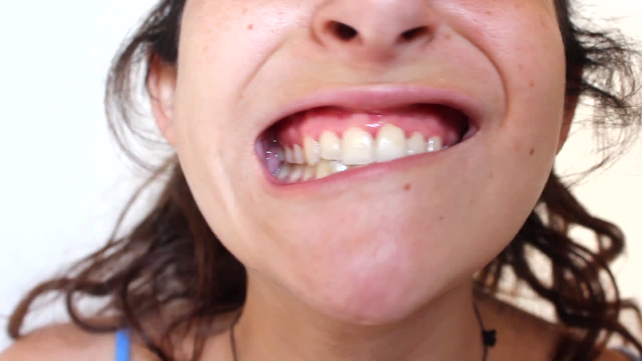mujer joven mostrando sus dientes