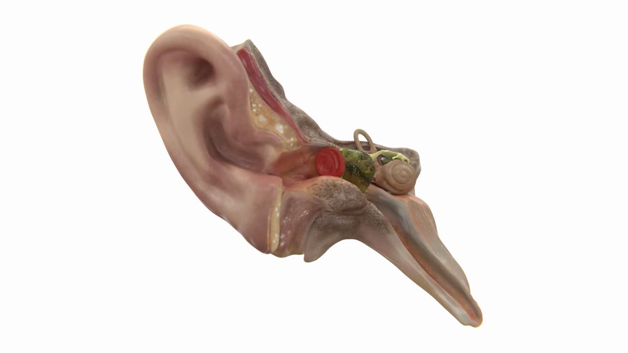 Video of Acute otitis media ear | Acute otitis medias video in vertical | Ear Infections video