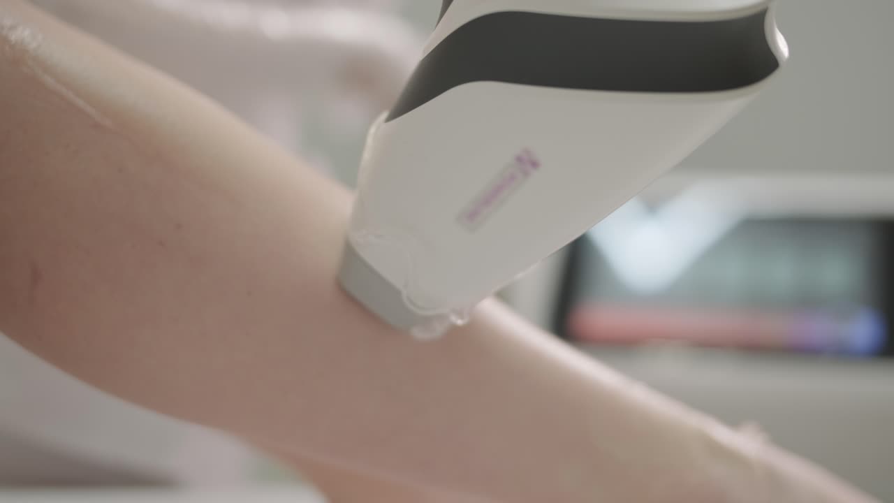 미용실에서 레이저 제거 및 화장품. 화장품, 스파 및 탈모 개념. 여성 다리의 레이저 탈모 절차. 장갑을 입은 의사.