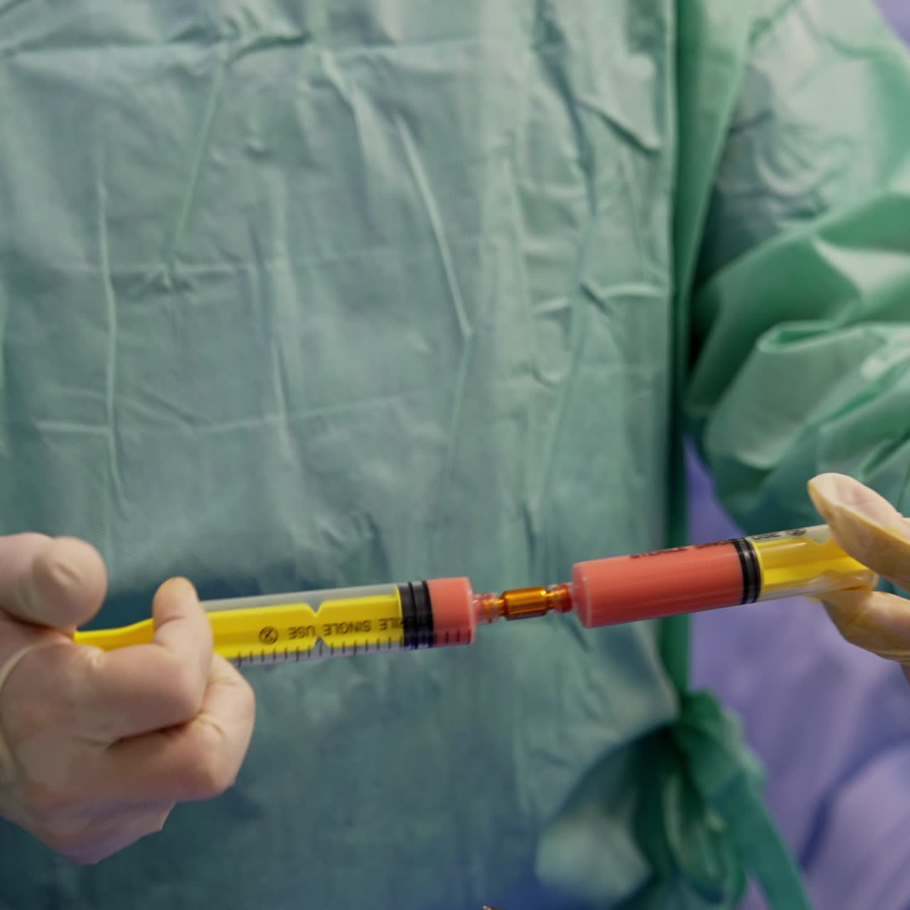 Doctor's hands in latex gloves hold the joined syringes. Specialist preparing stem cell for future operation. Close up