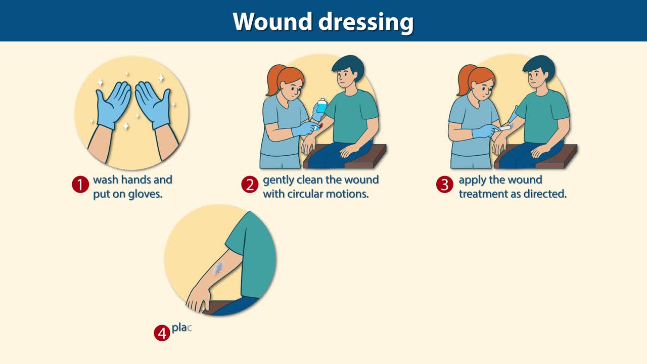 Animated guide illustrating wound cleaning, treatment application ...