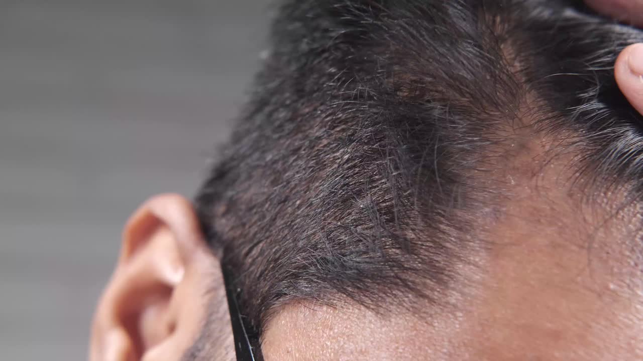 머리를 만지는 사람