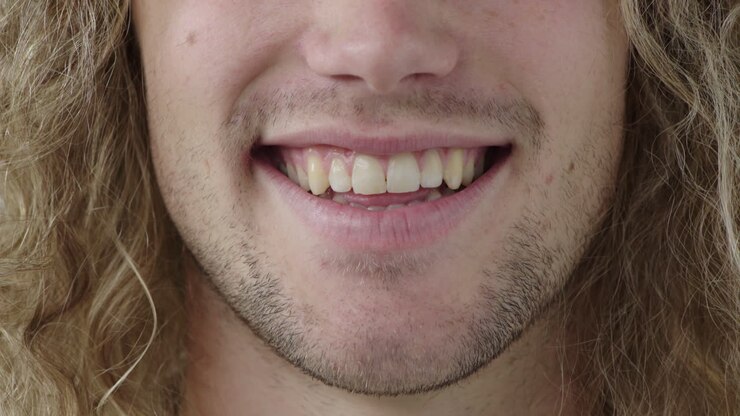 vicino bocca di giovane sorridente denti felici capelli facciali non rasati stoppia espressione allegra vicino