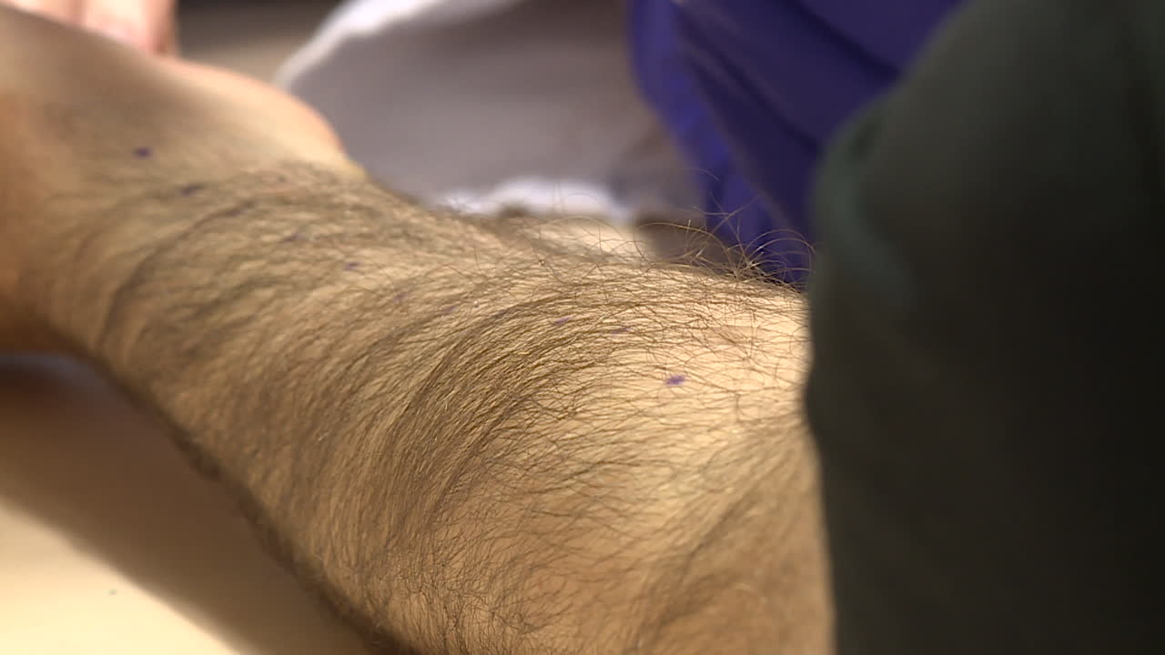 혈액 추출 절차