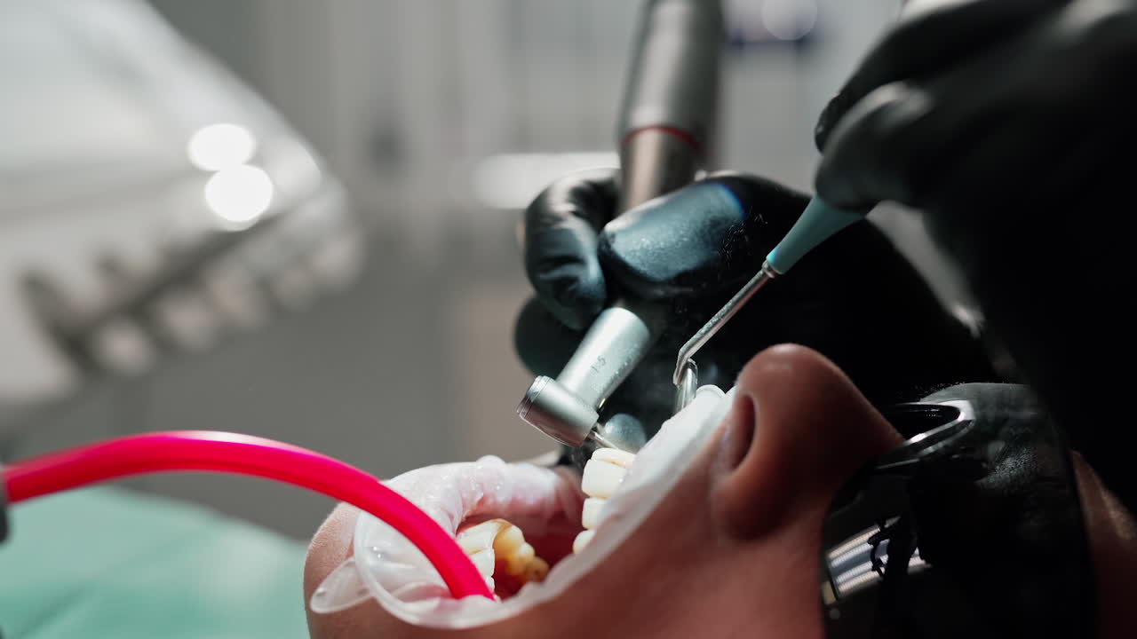 Patient during dental process. Close up of patient having dental treatment at dentist office