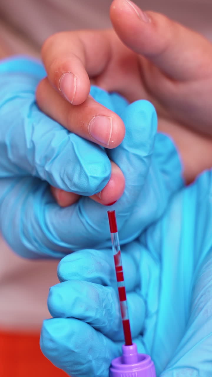 Medical worker taking blood sample. Hands in blue sterile gloves collecting blood from patient's finger. Close-up. Blood test. Vertical video