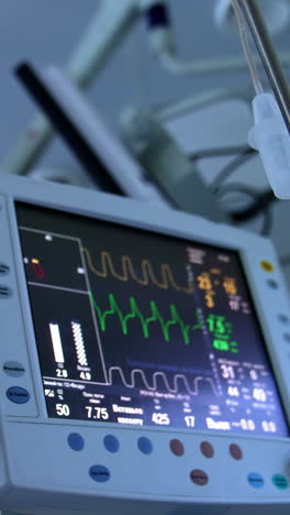 diverse parameters of life parameters of patient under surgical procedure. drop counter stand near the monitors. close up. low angle view. vertical video