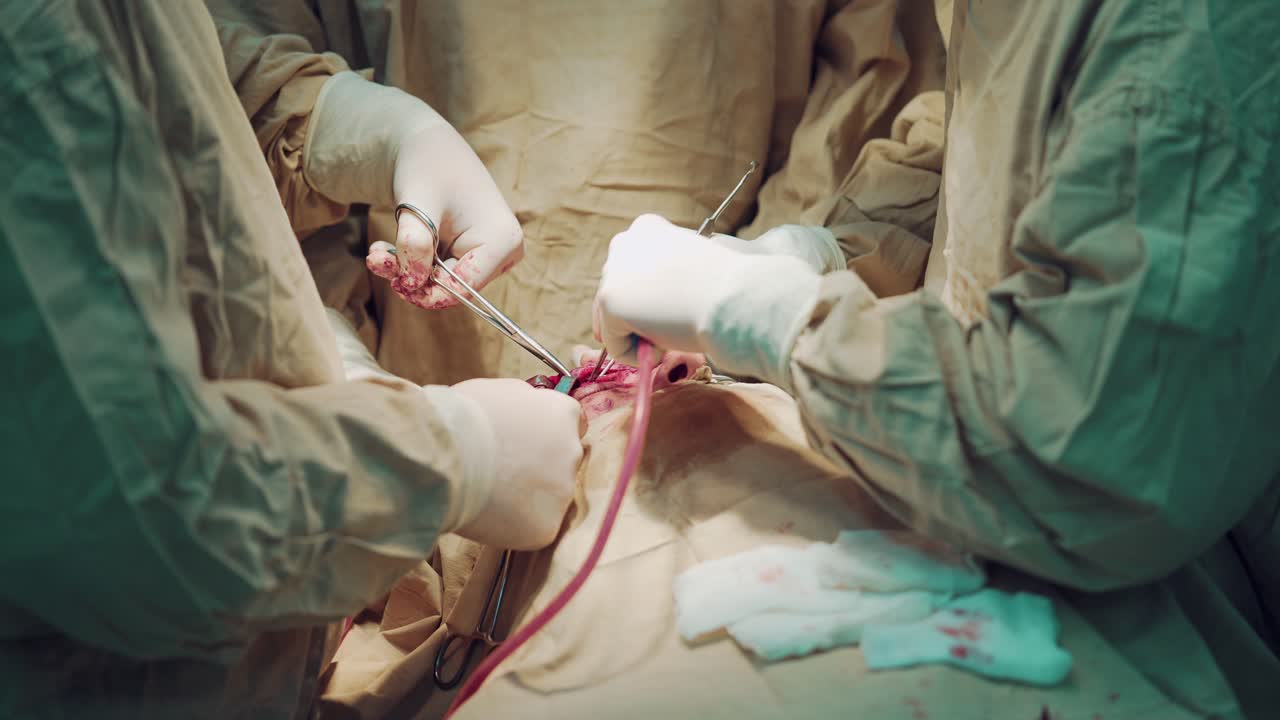 Medical team performing operation in hospital operating theater. Working with surgical instruments