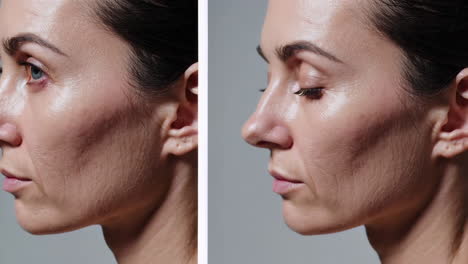 before and after facial treatment