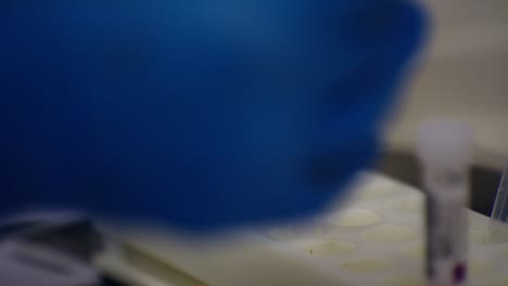 blood sample collection in a laboratory