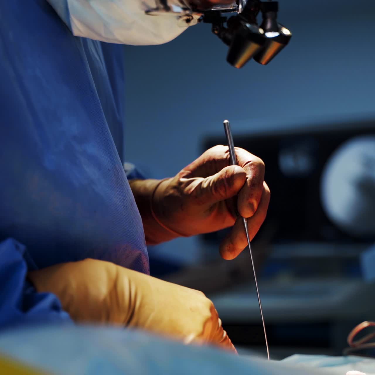 Professional doctor in mask conducts a surgery. Surgeon in surgical lights on head performing an operation to a patient with medical instrument