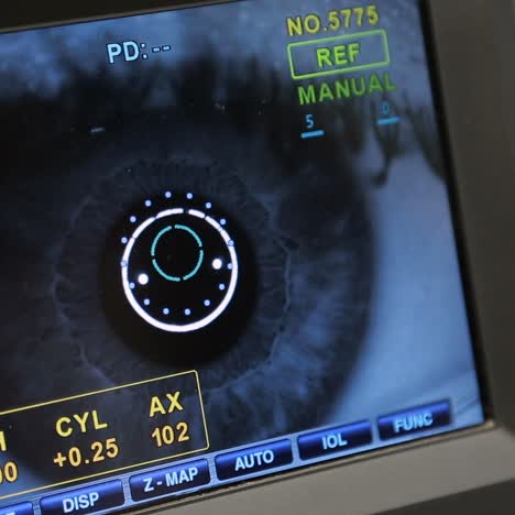 Eye Examination Scan Results