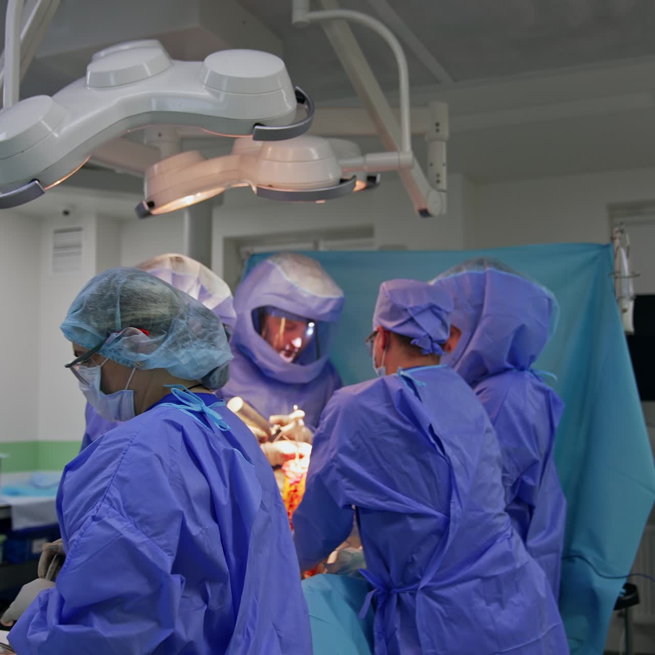 Group of four doctors cooperate in surgery room. Team of surgeons wear protective suits. Nurse comes up to bring instruments to the specialists
