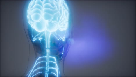 examen de radiología del cerebro humano
