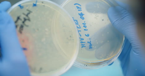 scientist looking at bacteries in petri dish at laboratory 1