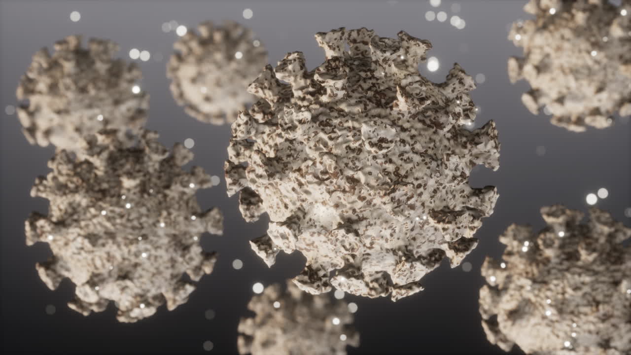 심각한 급성 호흡기 코로나-19의 현실적인 영상