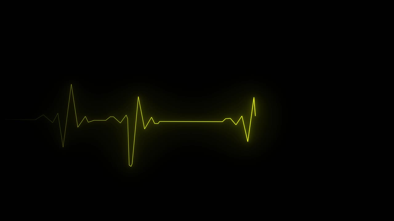 Yellow EKG heartbeat line with multiple pulses moves across black screen. For medical, health, or technology concepts