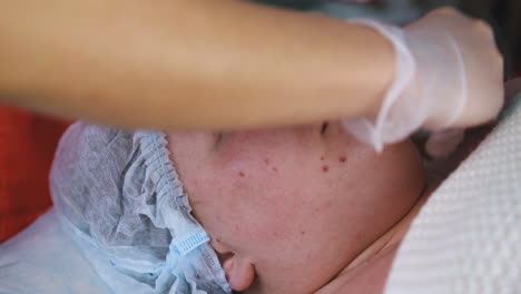 cosmetologist in gloves cleans girl face with wipe in clinic