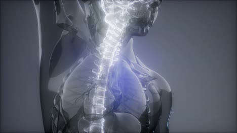 dolor de espalda en los huesos de la espalda