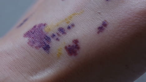 Colored marks on hand