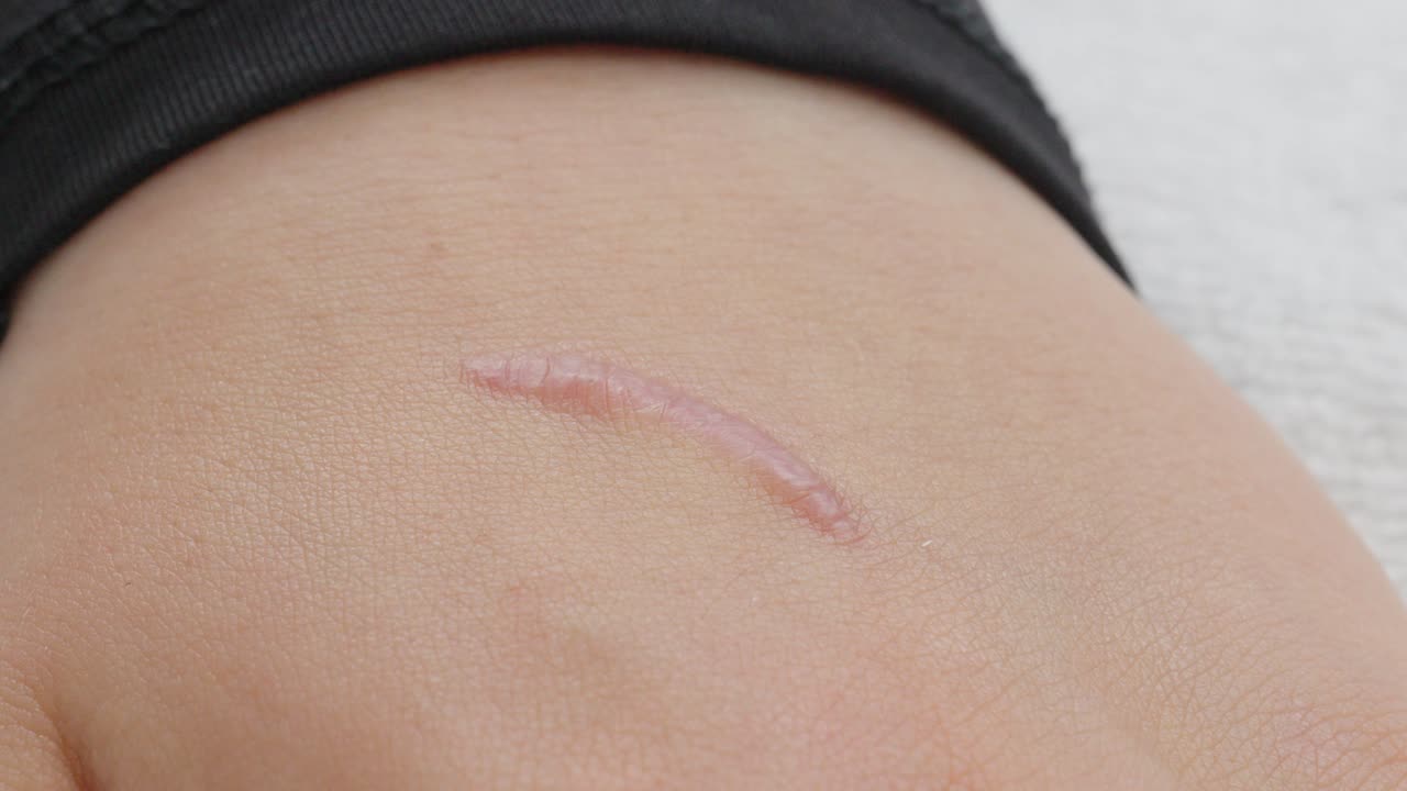 Skin scar inpection on hand.