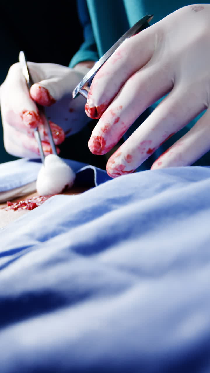 Close-up of surgeons performing operation in operation room