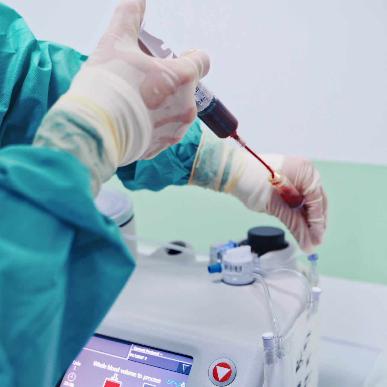 Stem cells injection procedure. Female worker pours blood from syringe into special machine. Modern equipment in clinic.