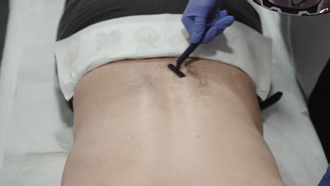 afeitar la parte inferior de la espalda del hombre para la depilación láser