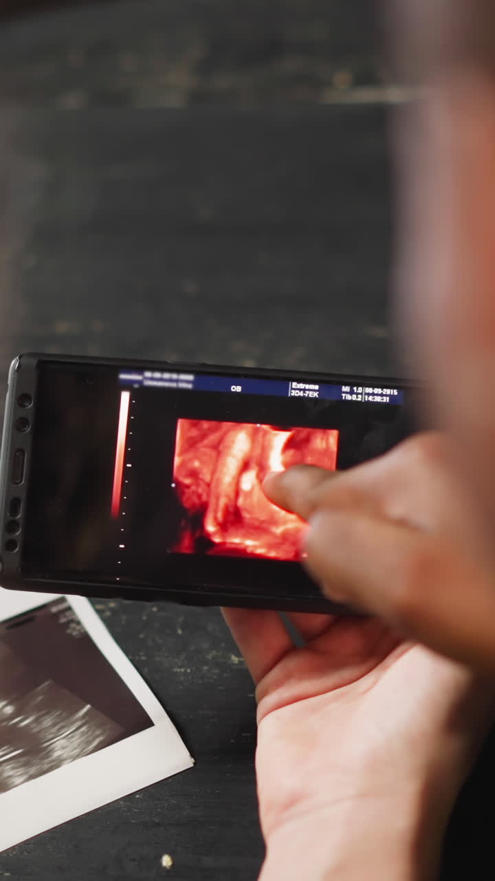 Family of white woman and black husband watches baby ultrasound record on smartphone touch screen in living room close view slow motion