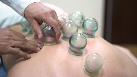 cupping therapy treatment session