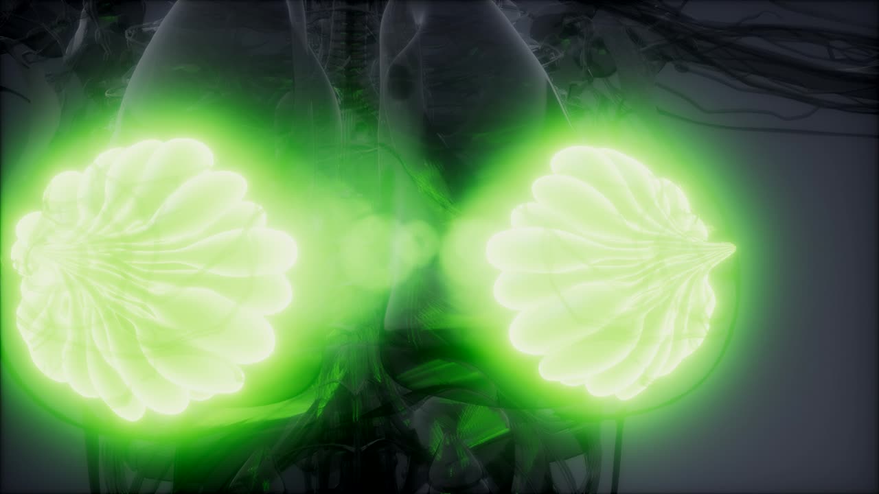 ilustración médicamente precisa de las glándulas mamarias de una mujer obesa