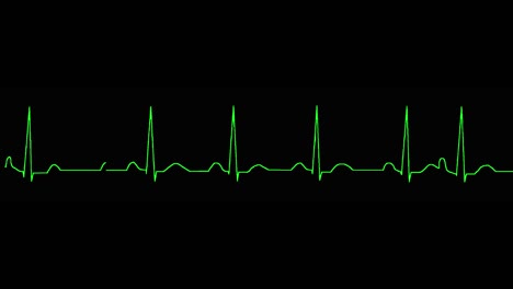 el ecograma muestra una contracción auricular prematura (apc)