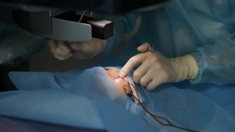 laser vision correction. a patient and team of surgeons in the operating room during ophthalmic surgery