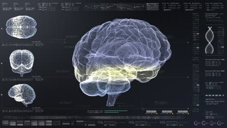 Concepto-Médico:-Pantalla-Futurista-De-Análisis-De-Escaneo-Cerebral-Holográfico-Virtual-Patología-Neuronal-Biomédica-Y-Datos-De-Diagnóstico-Para-Alzheimer-Y-Trastorno-Mental