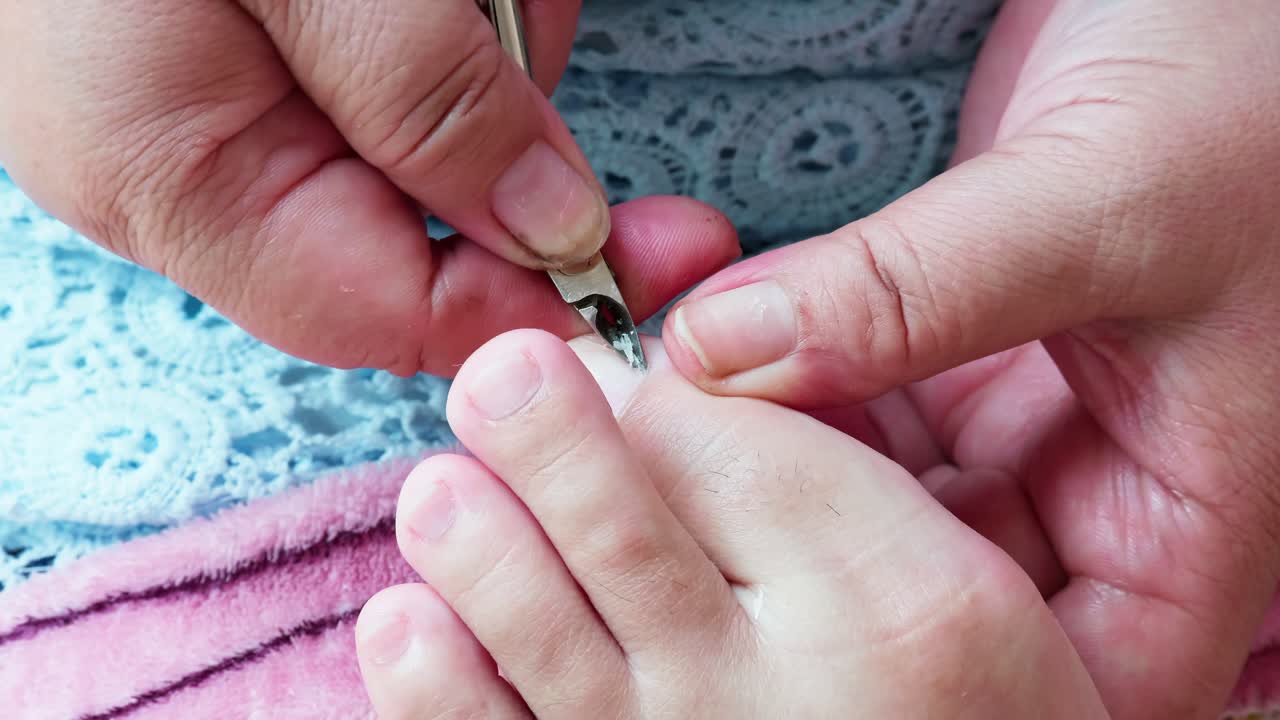 procedimiento de pedicura médica profesional con instrumento cortauñas-2